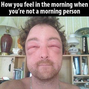 Meet your Posher, Owen